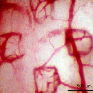 幫助血管修復(fù)的智能繃帶