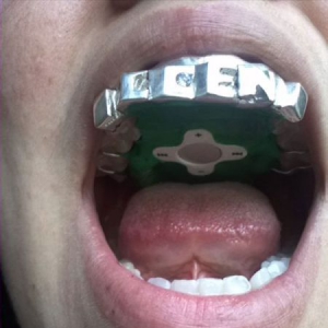 從嘴里聽音樂——另類MP3