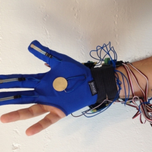 輔助醫(yī)生治療的智能手套