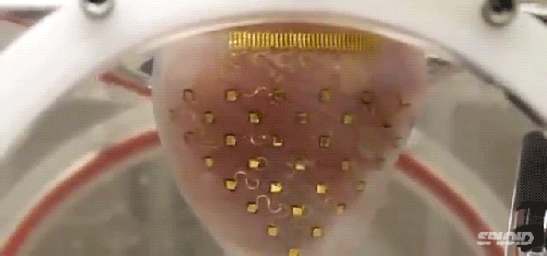 讓心臟持續(xù)跳動的電子心包膜