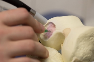 “寫骨“手術(shù)筆