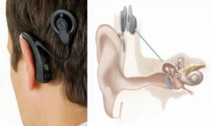 梅尼埃爾氏綜合癥病友的新輔助設備